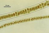 5 – Dettaglio delle cellule con plastidio stellato